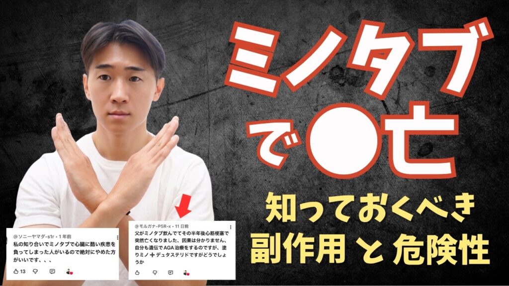 【薄毛・AGA治療】ミノタブで●亡？！ミノキシジルの知るべき効果と副作用について